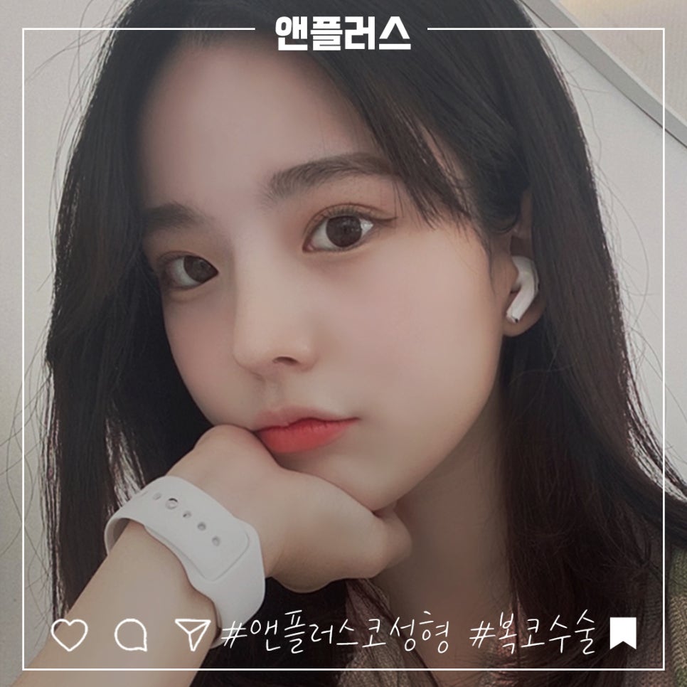 복코수술후기 뚱뚱한 코끝 개선 관련 이미지 1
