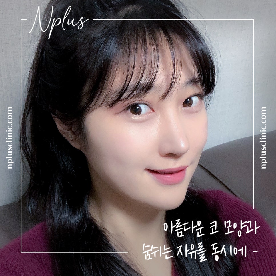A Satisfying Result with One Rhinoplasty and Rhinitis Surgery image 13