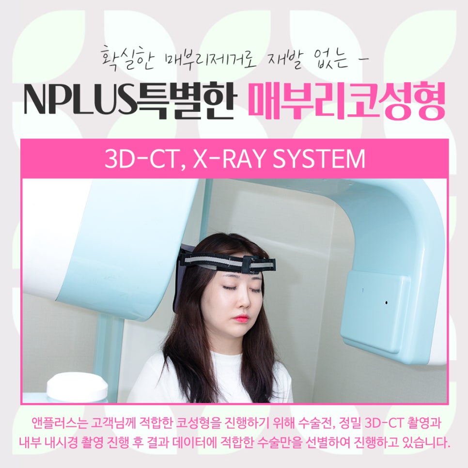 A Refined Look Through Female Hump Nose Surgery image 7