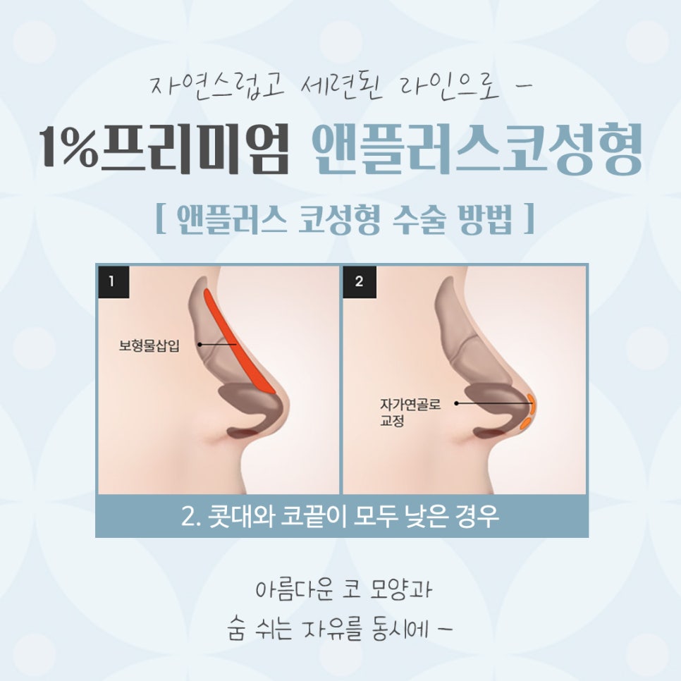 늑연골코수술 내용을 확인해 보고 관련 이미지 10