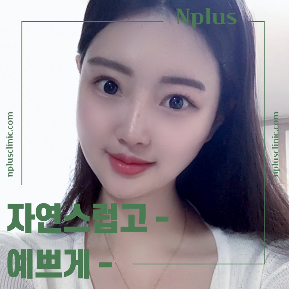 Nose Surgery Review Using Autologous Cartilage image 16