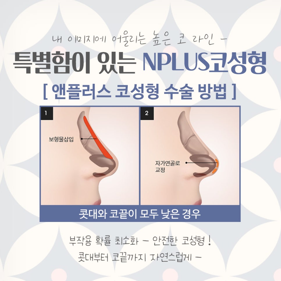 코수술후기 기능까지 확인하고 관련 이미지 8