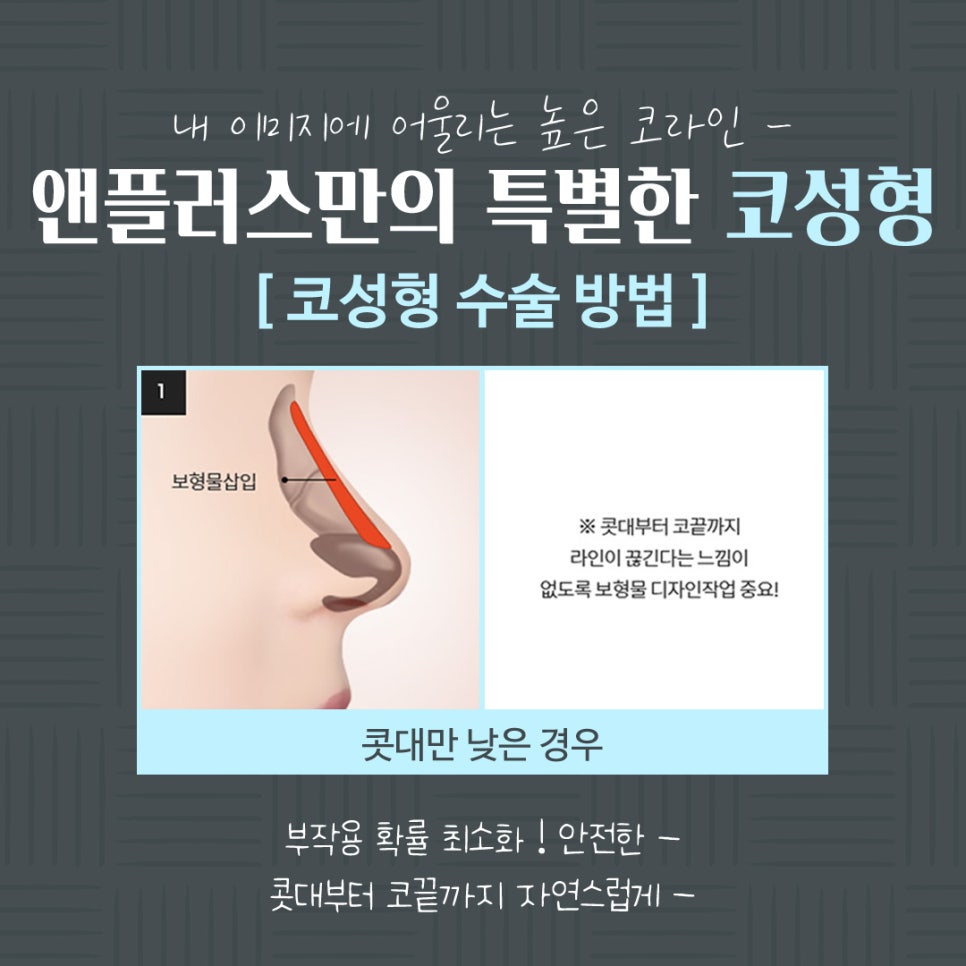 코수술전후 확실한 차이 관련 이미지 8