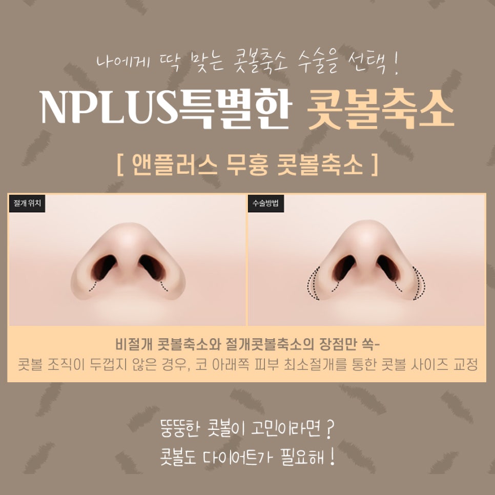 콧볼축소후기 퍼진코에 변화를 관련 이미지 6
