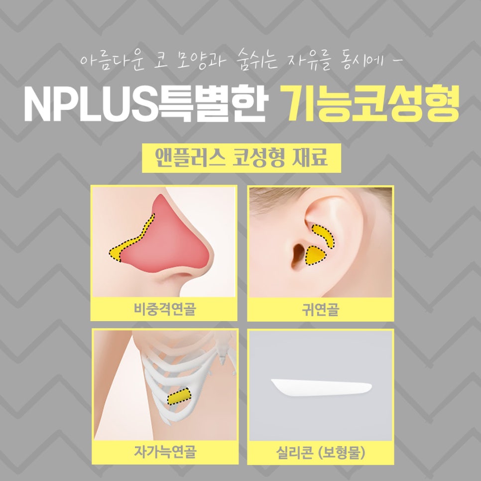 기능코성형을 통한 한쪽 코막힘 개선 관련 이미지 10