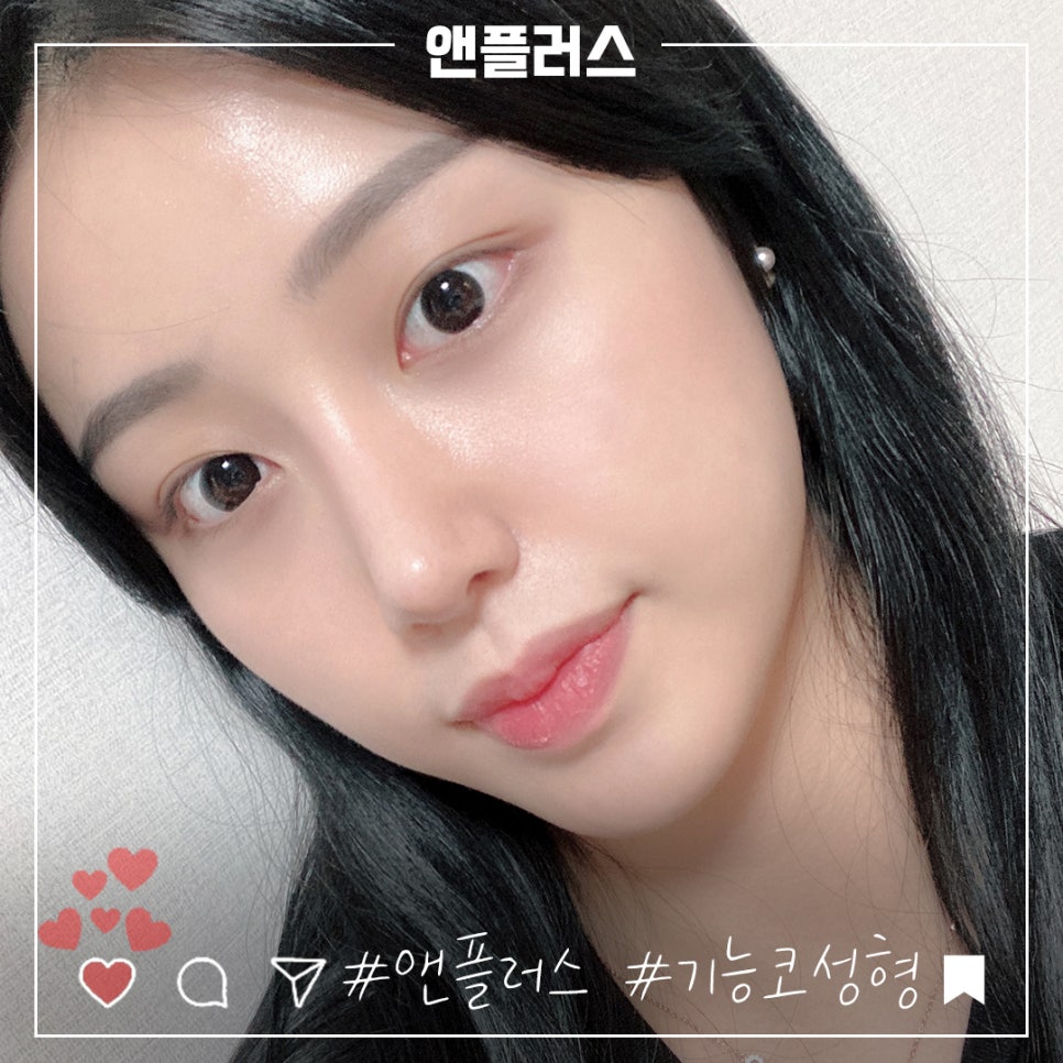 Before and After Female Nose Surgery in Various Ways image 11