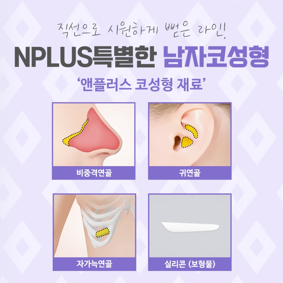 A Nose Line That Suits You, Even in Men's Rhinoplasty Reviews image 7