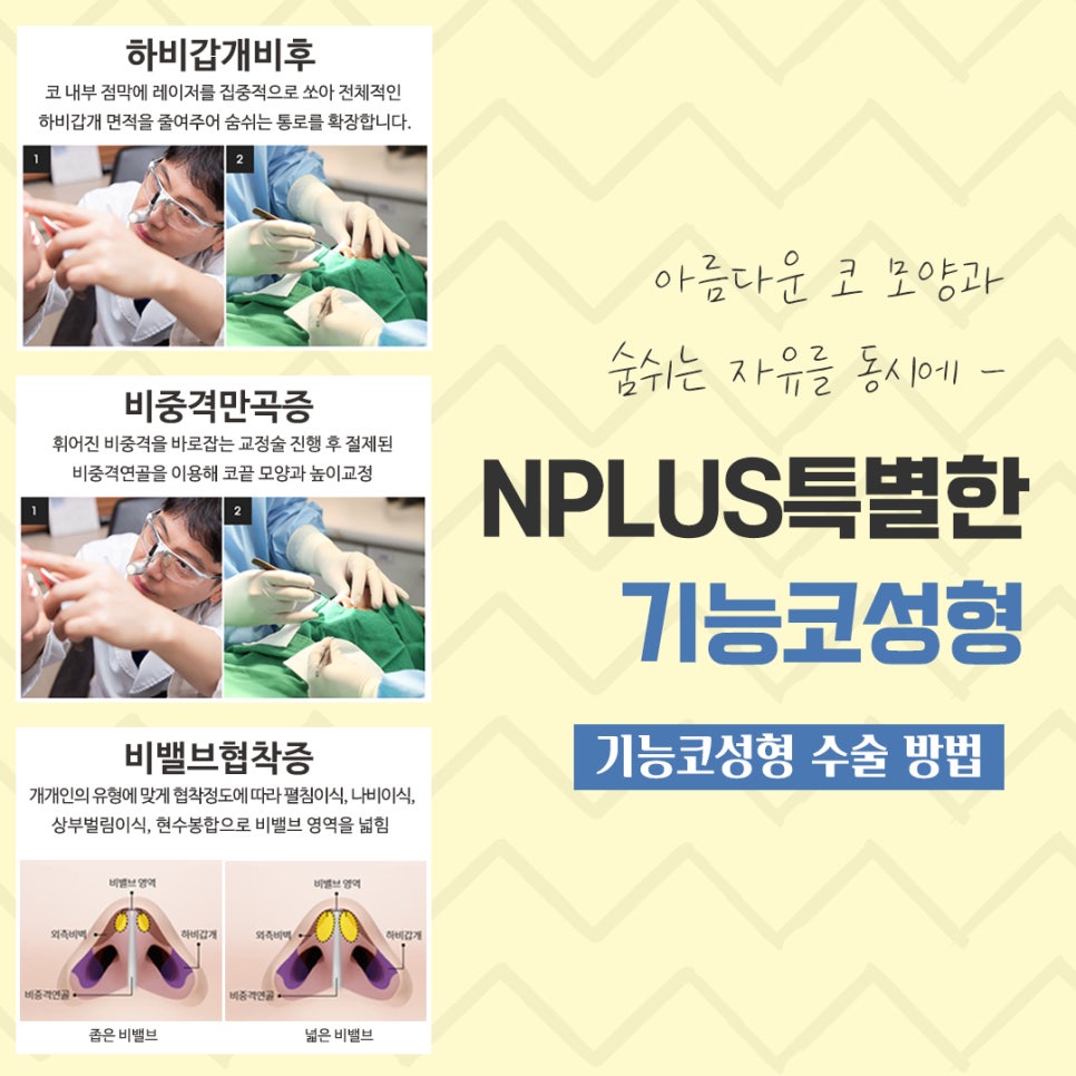 A Clear Choice for Rhinitis Nose Surgery image 7