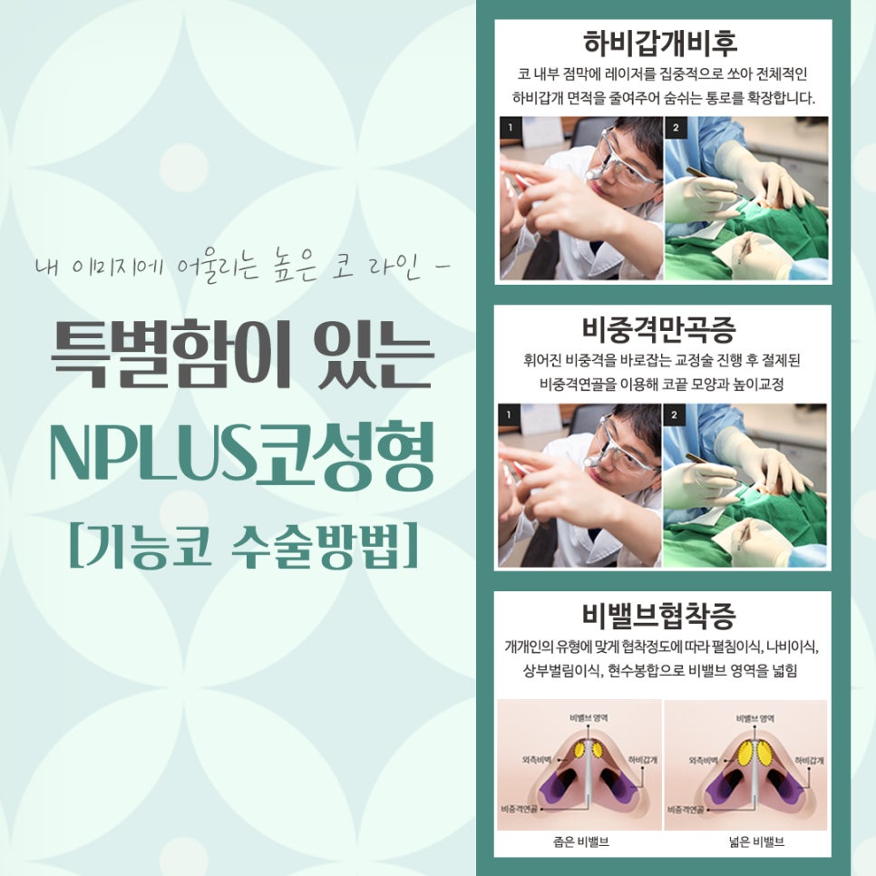 코수술잘하는곳 신중하게 선택 관련 이미지 11