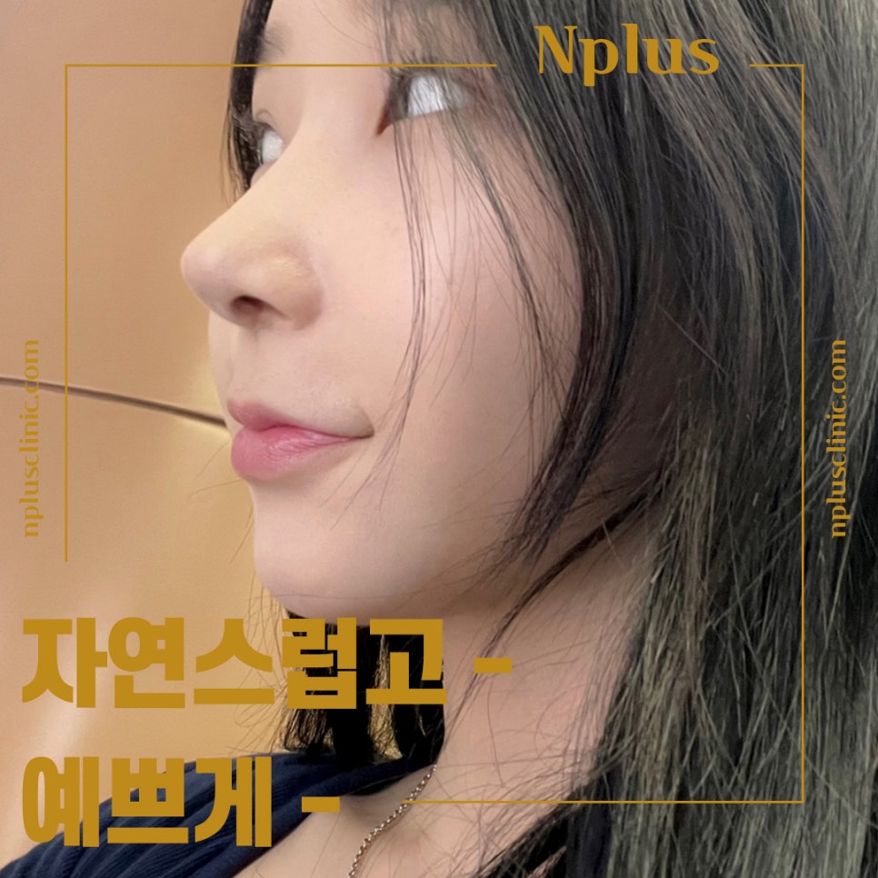 무보형물코수술후기 다양한 내용을 알아보고 관련 이미지 3