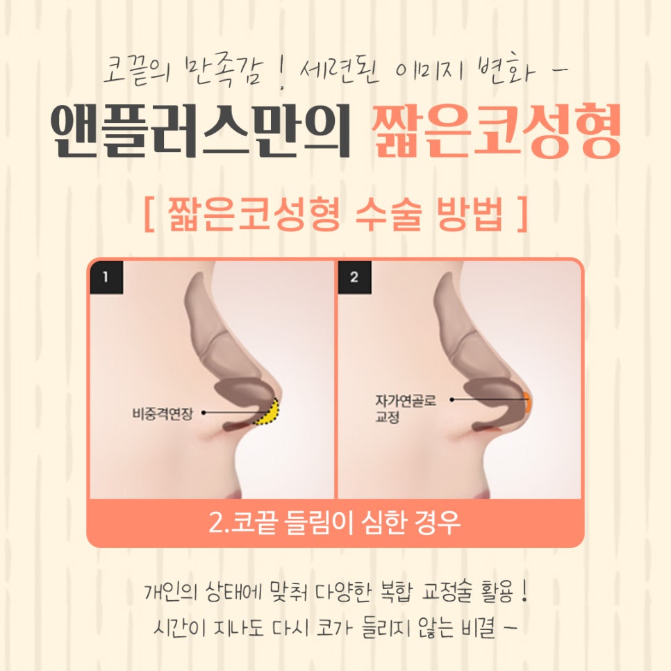 짧은코수술에 대한 정보를 찾는다면 관련 이미지 11