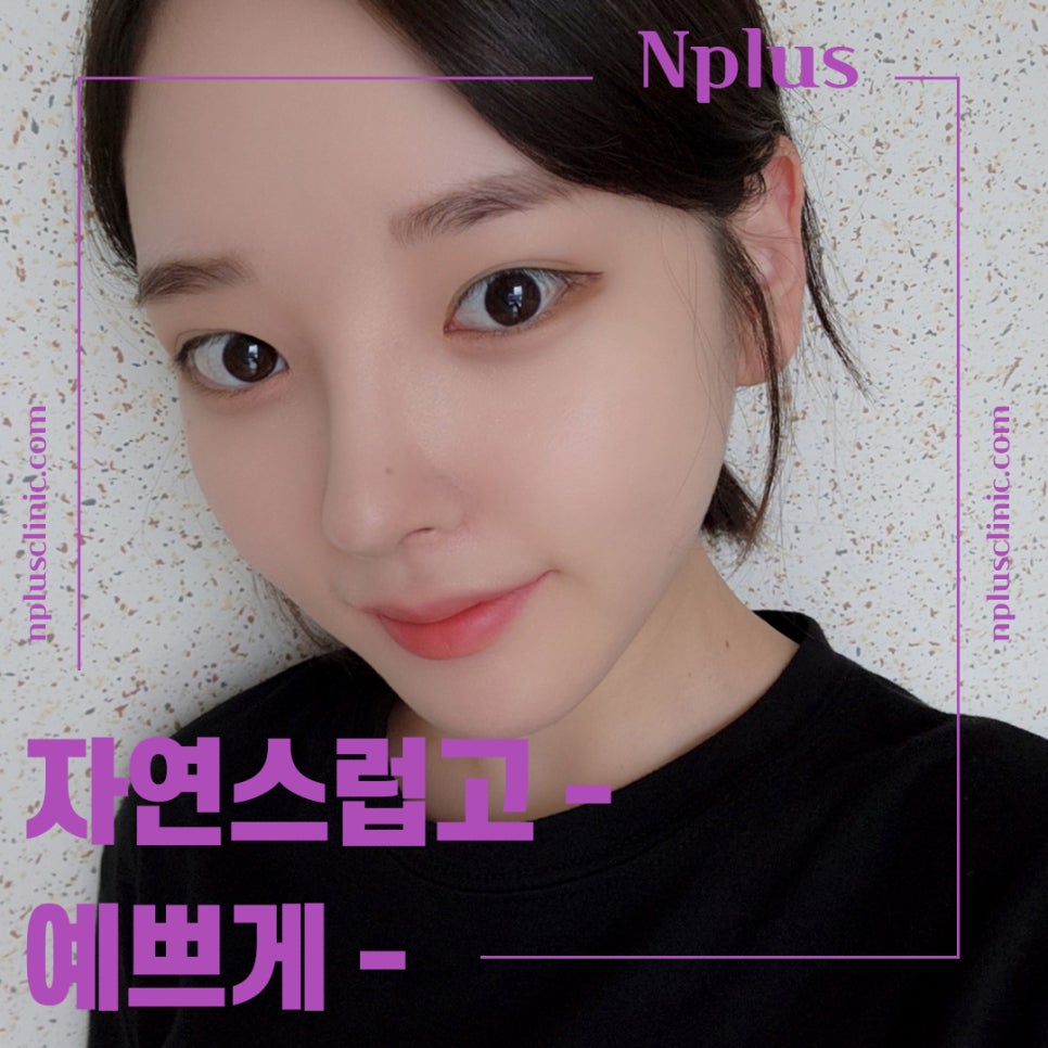 복코수술후기에 대해 세세하게 알아보고 관련 이미지 13