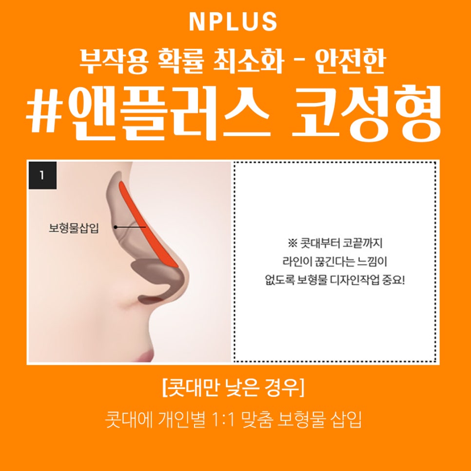 Increased Confidence with Low Nose Surgery image 5