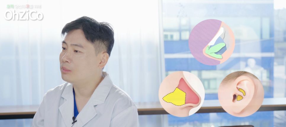 Pros and Cons of Autologous Rib Cartilage and Donor Rib Cartilage! image 3