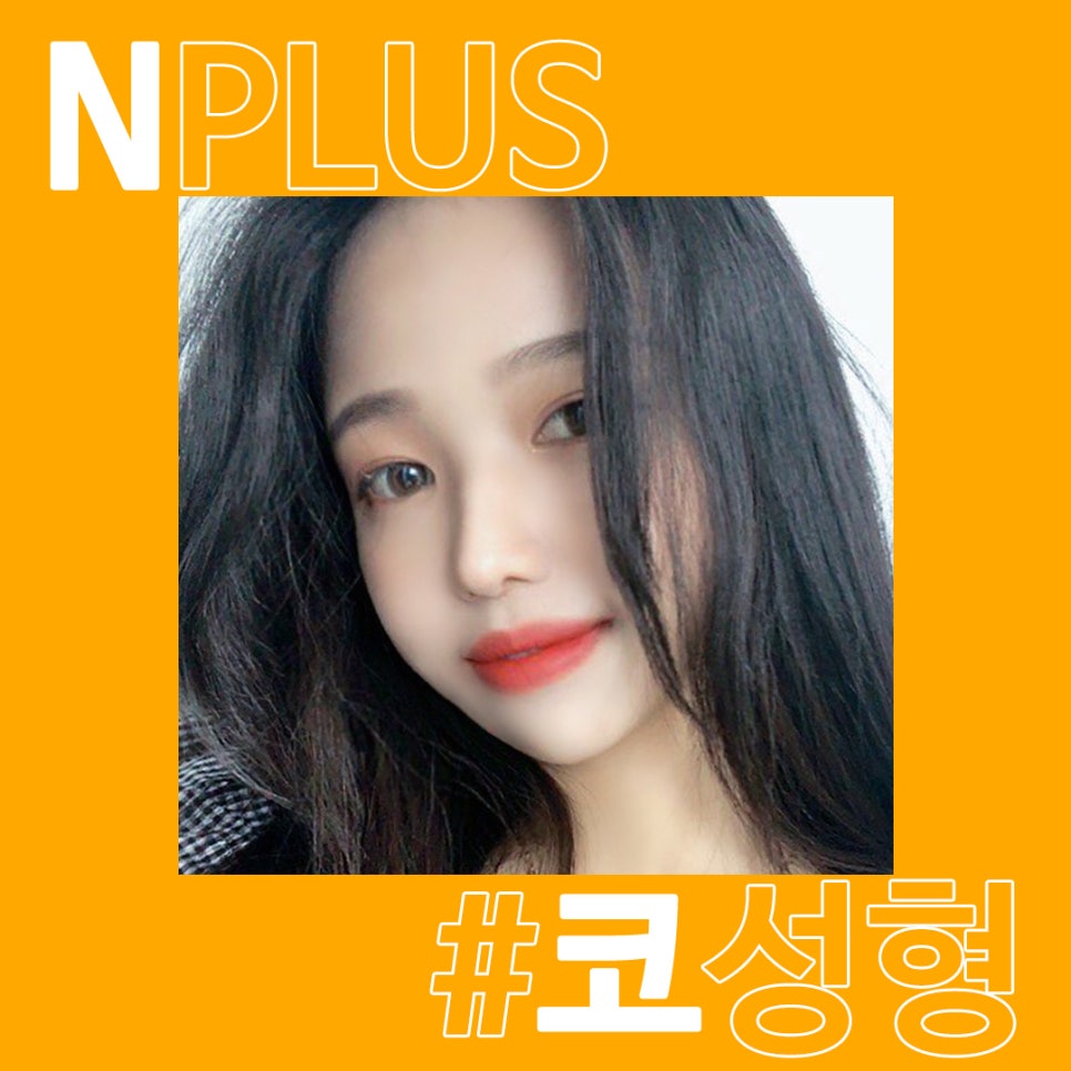 콧대수술_비염기능까지 고려해서 관련 이미지 1