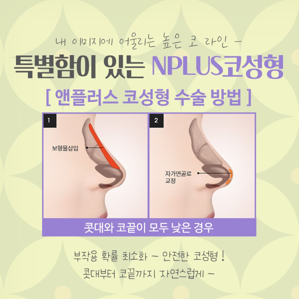 압구정코수술에 대해 찾아보고 관련 이미지 8