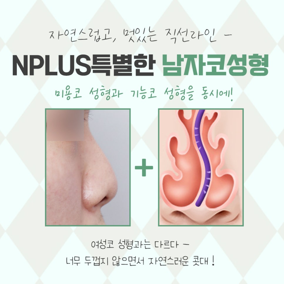 Learn More About Male Rhinoplasty Reviews in Detail image 4