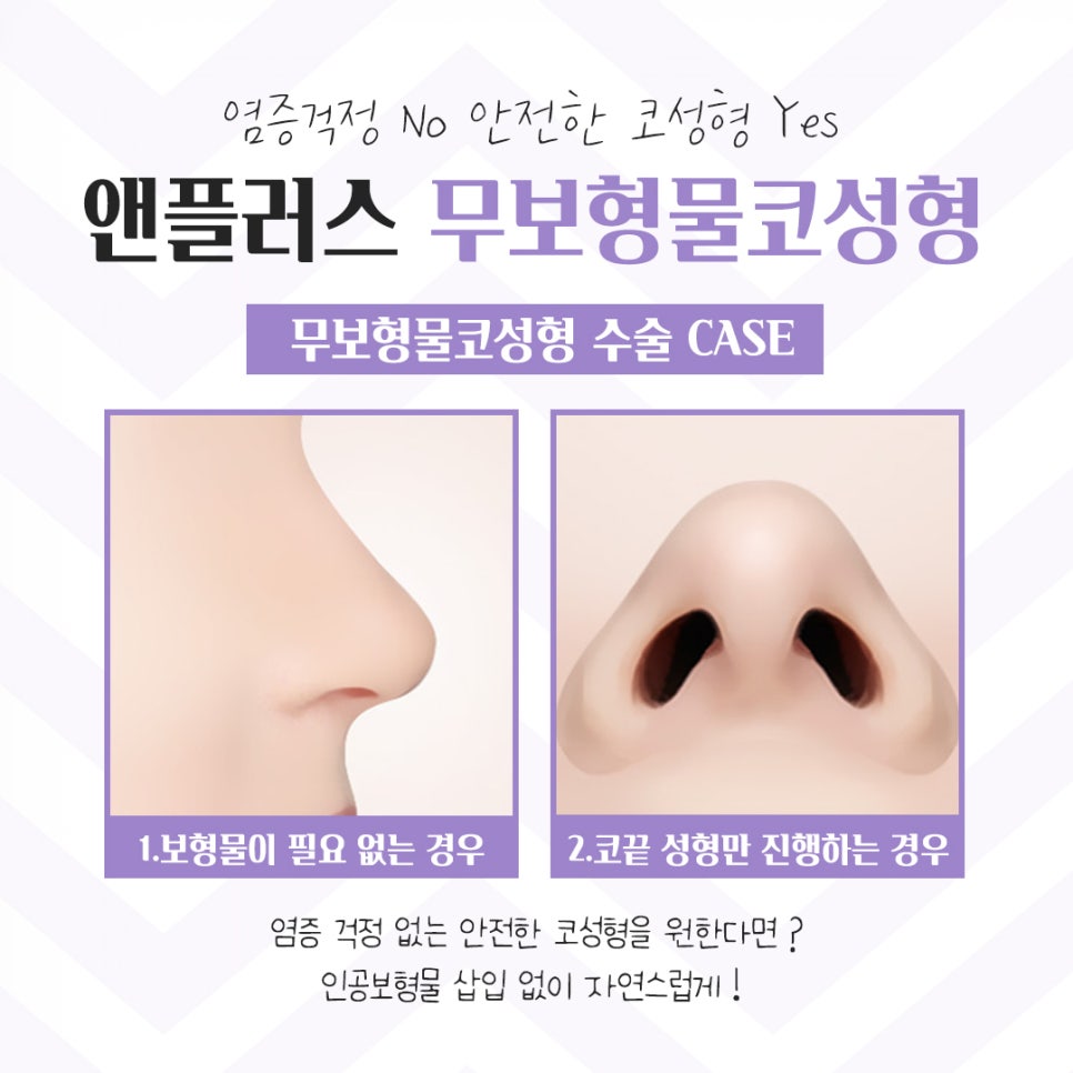 Learn More in Detail About Reviews of Nose Surgery Without Implants image 9