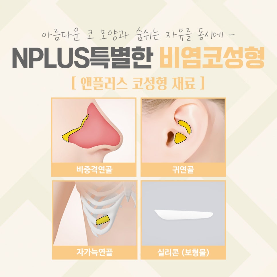 비염코수술후기를 잘 알아보고 관련 이미지 9