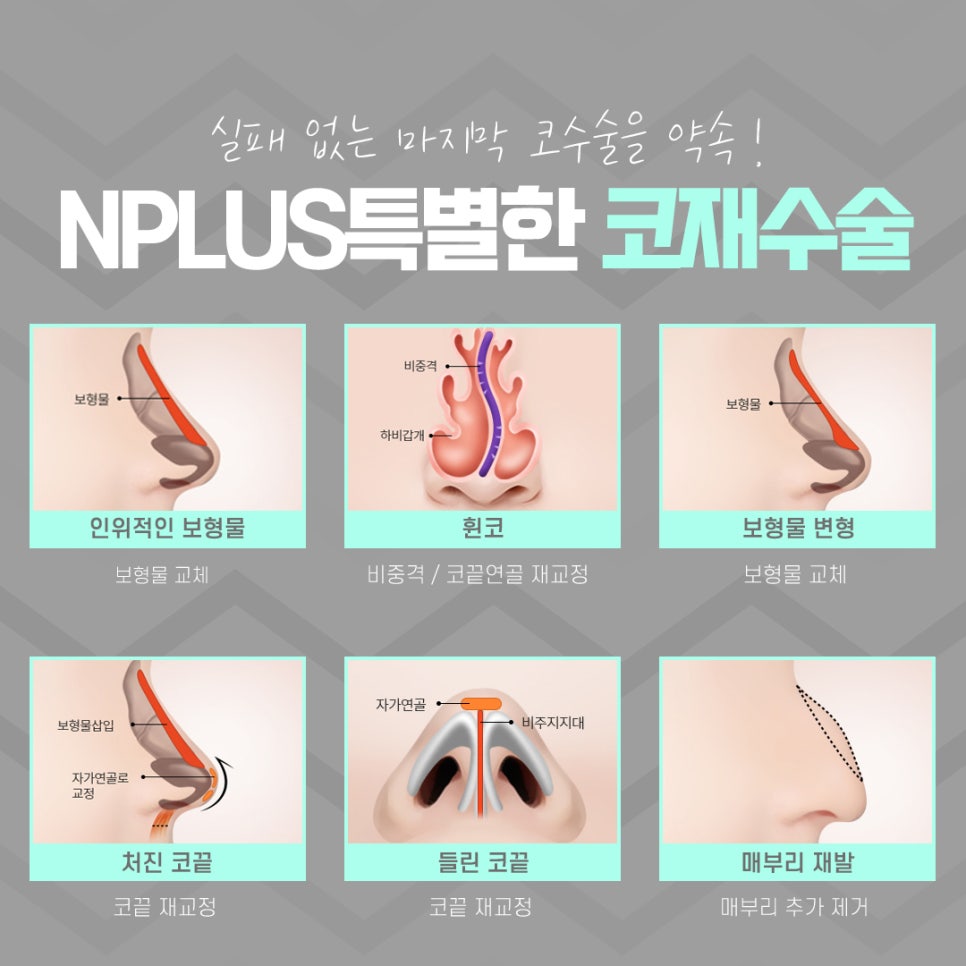 코재수술성형외과 선택의 중요성 관련 이미지 10