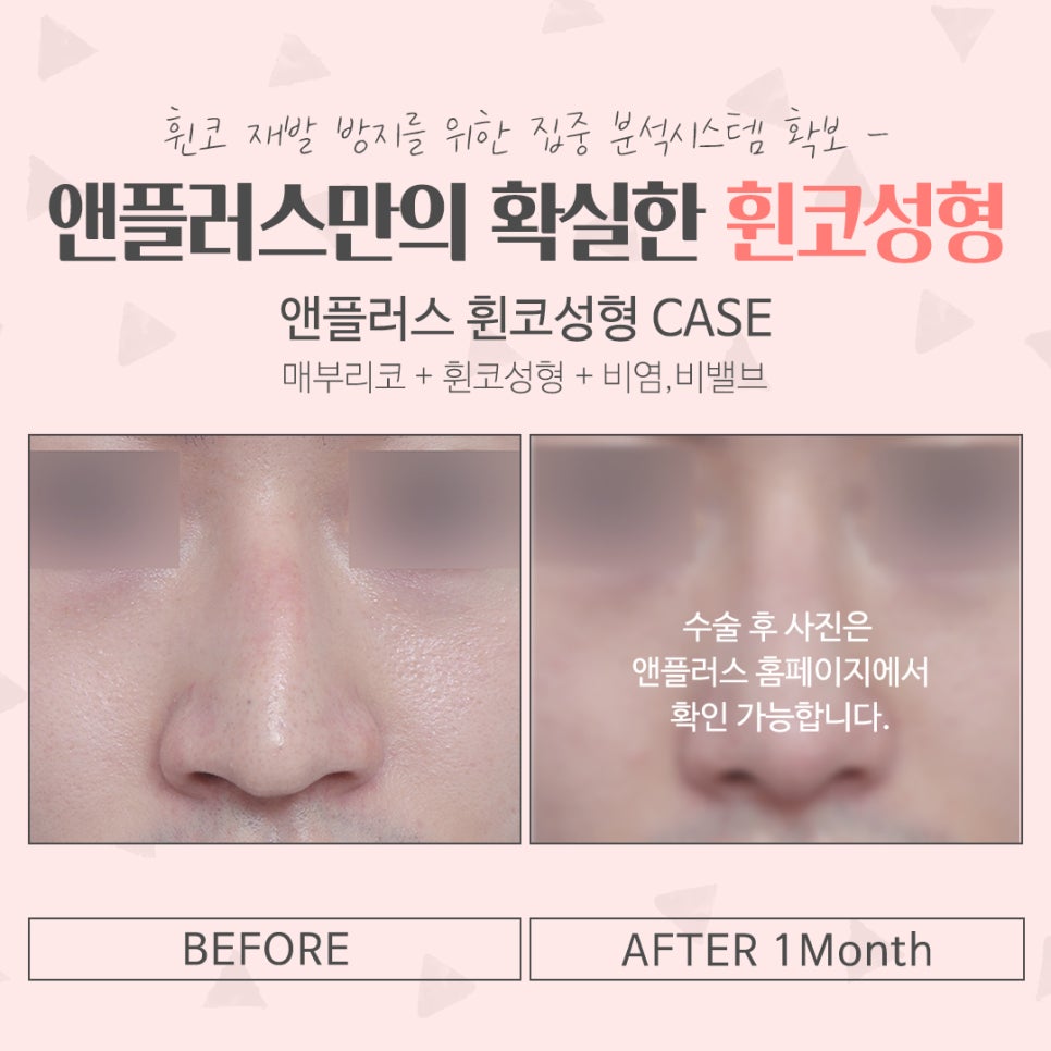 휜코수술후기 정확한 진단을 통해 관련 이미지 13