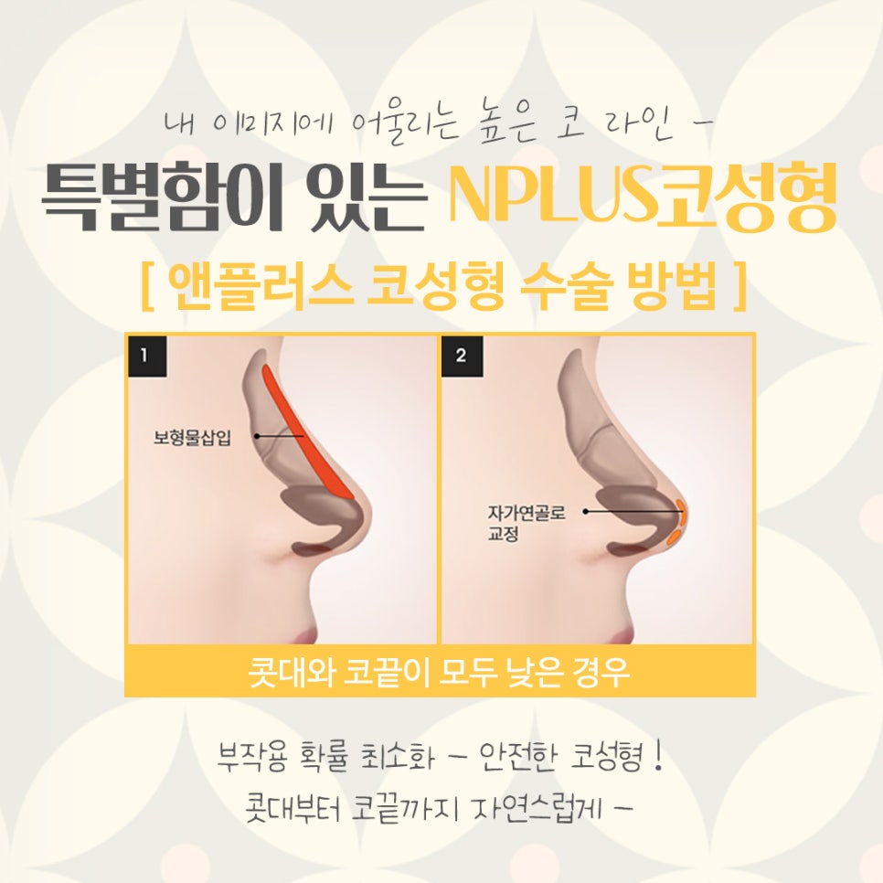 코성형잘하는병원에 대해 알아보고 관련 이미지 7