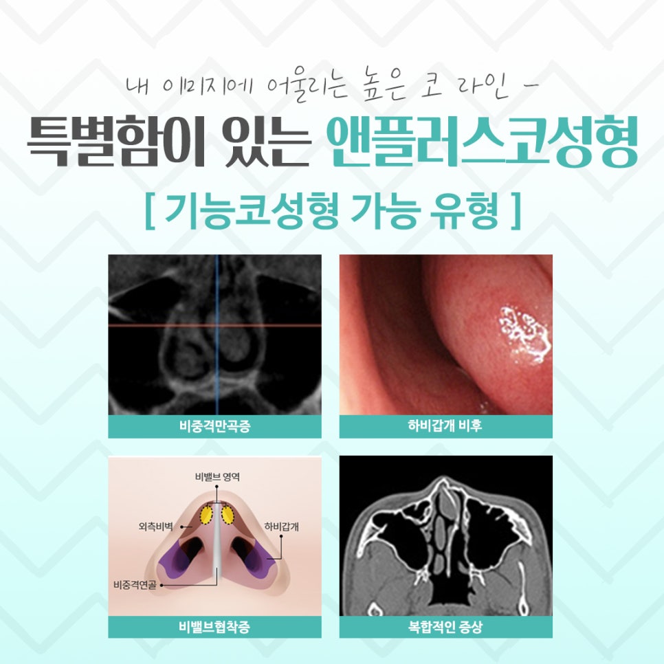 첫코수술 문제를 정확하게 파악하고 관련 이미지 5