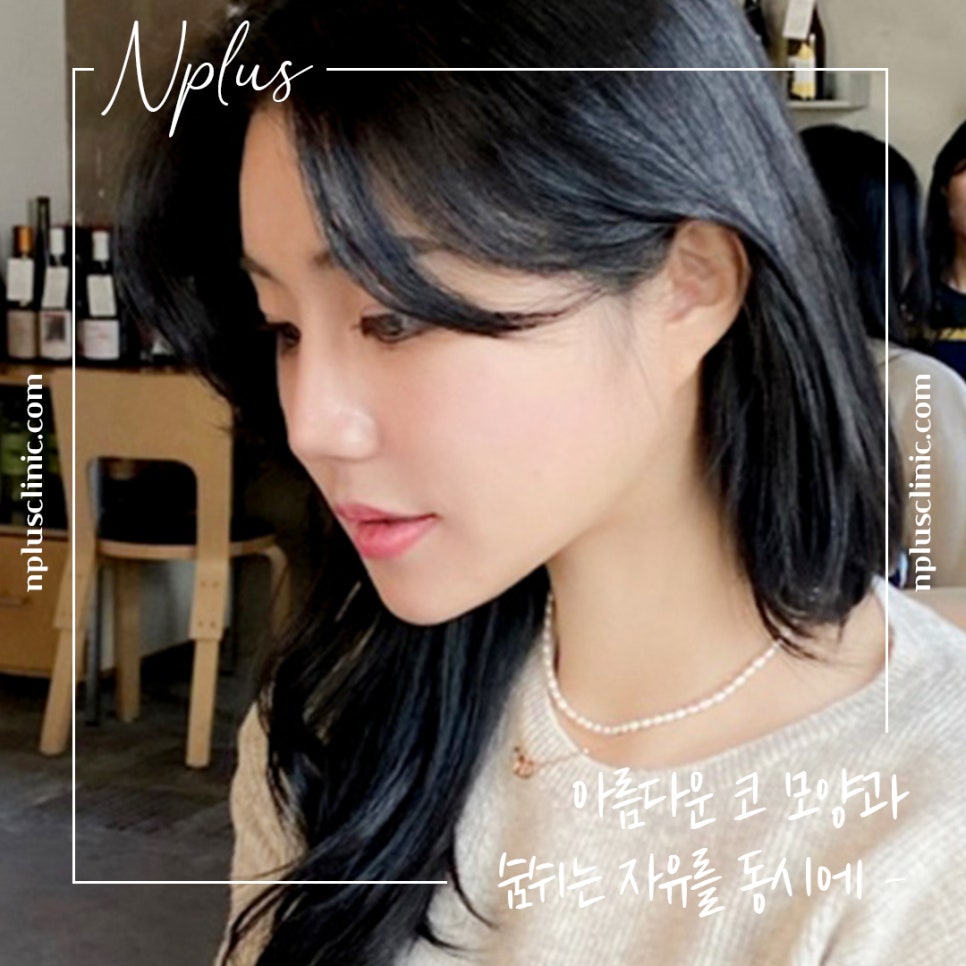 Natural Progress in Nasal Alar Reduction Surgery Review image 10