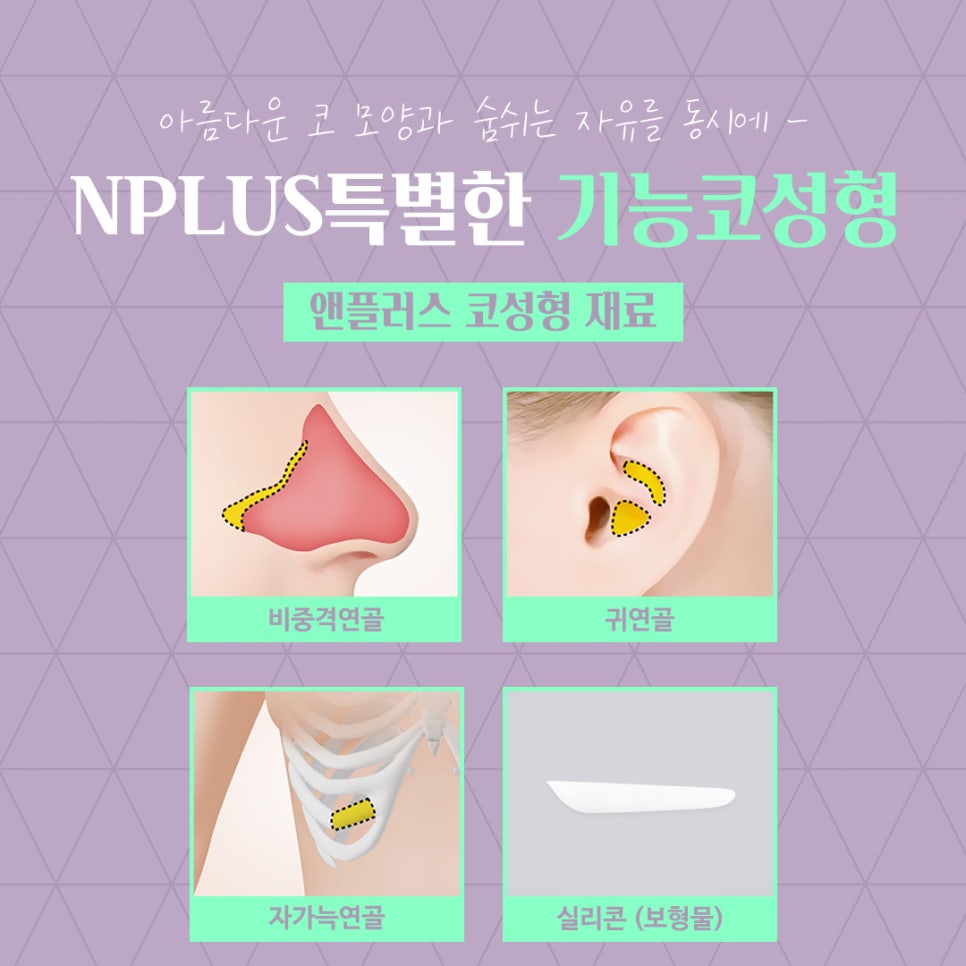 앤플러스의원에서 알려드리는 기능코성형 관련 이미지 11