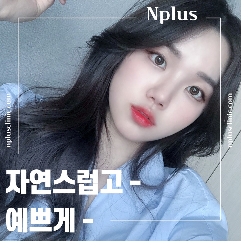 Rhinoplasty Review: Improved with a Refined Line image 2