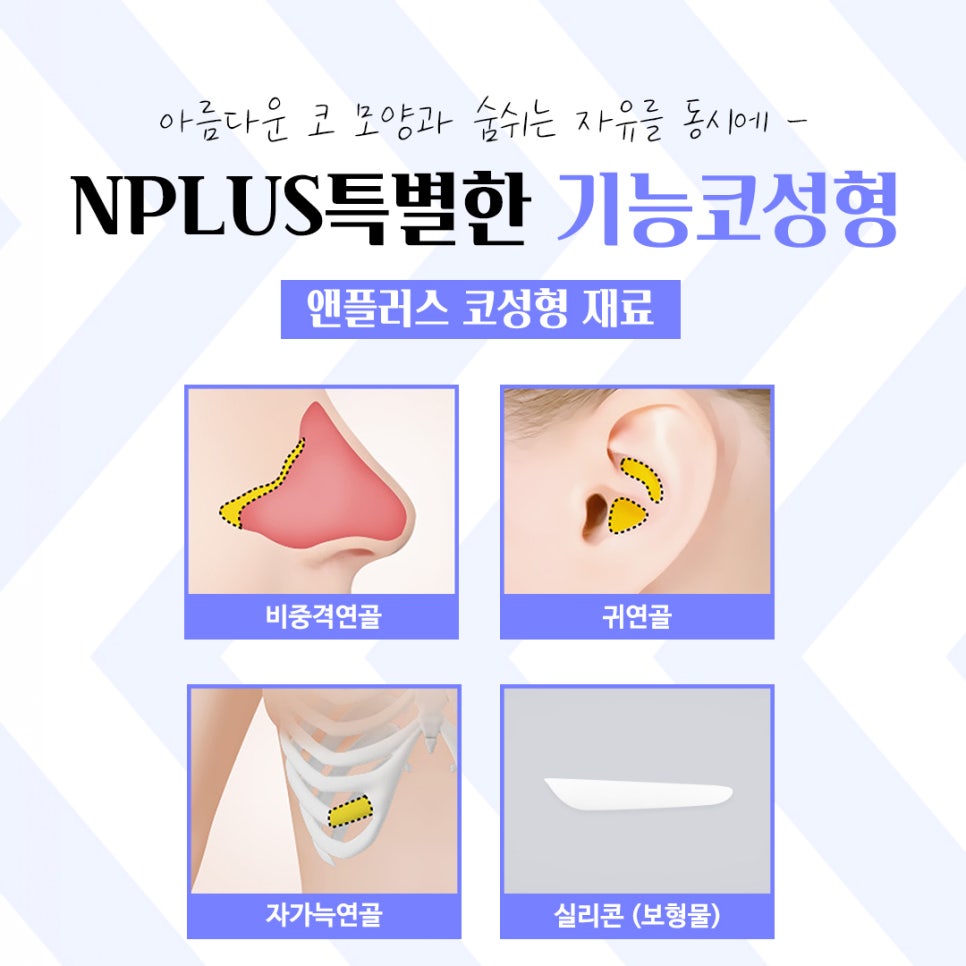 기능코성형후기 다양한 변화를 확인하여 관련 이미지 11