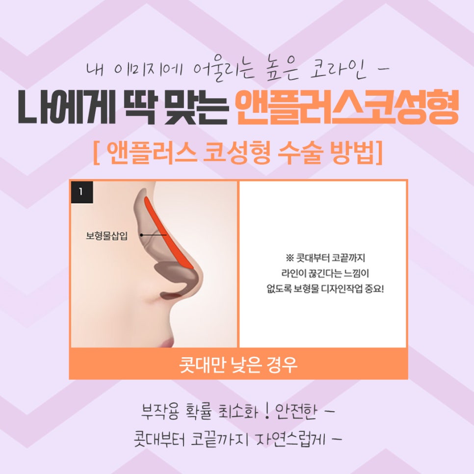 코수술후기 코 내부까지 확실하게 알아보고 관련 이미지 9