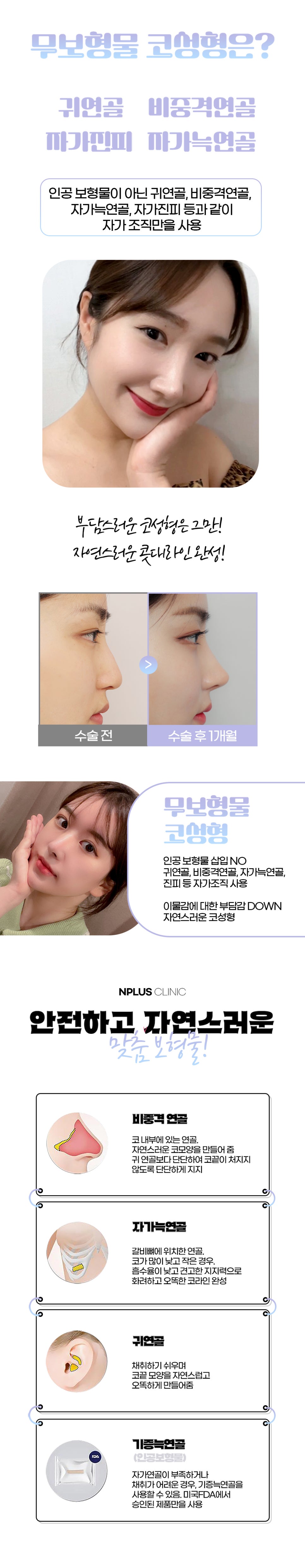 앤플러스에서 진행하고 있는 무보형물 코성형이벤트 관련 이미지 3
