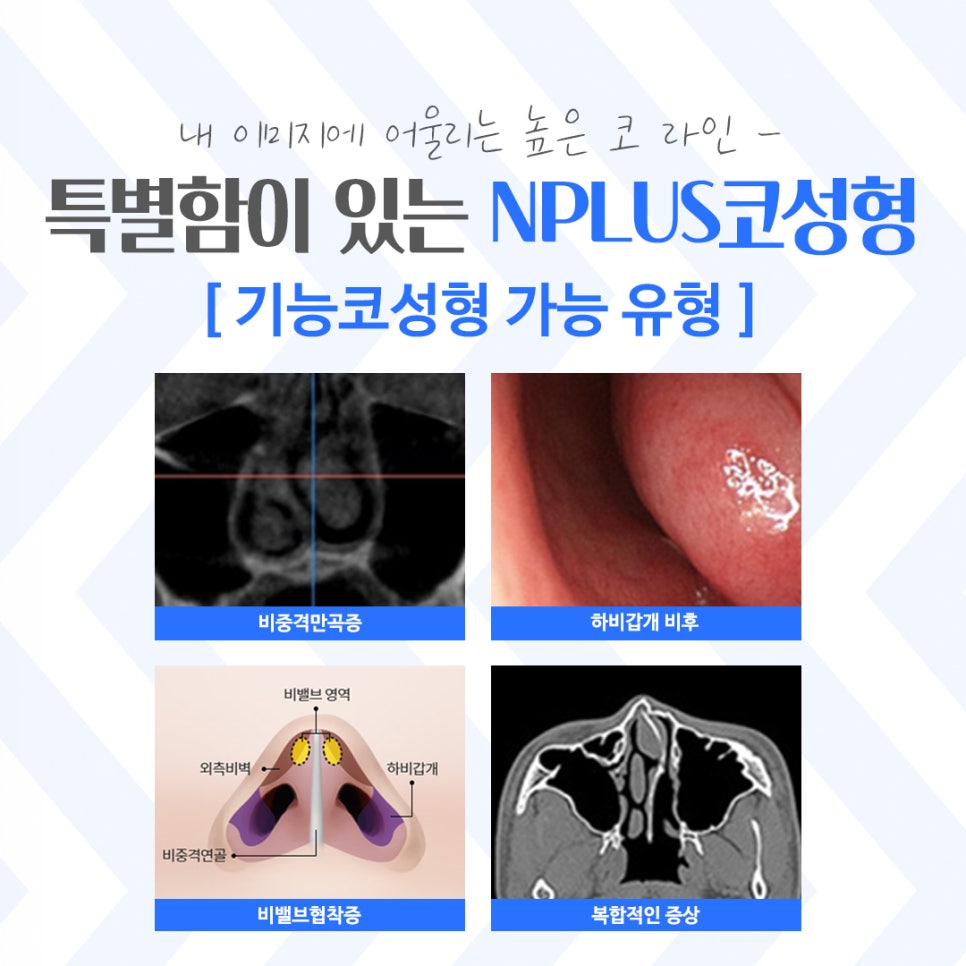 Learn More at a Place Known for Rhinoplasty image 6