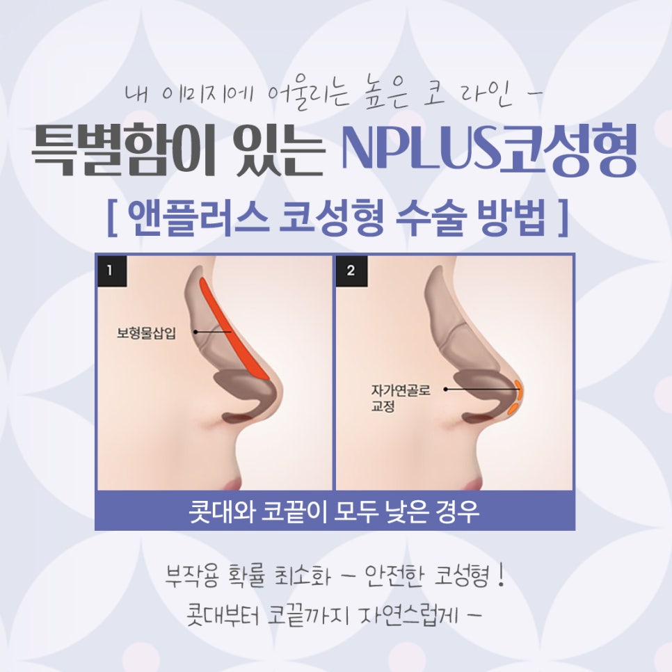 코성형잘하는곳에서 자연스럽고 예쁘게 관련 이미지 8