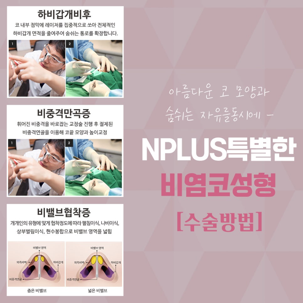 Nasal Surgery Review: Make Sure You Understand It Clearly image 9