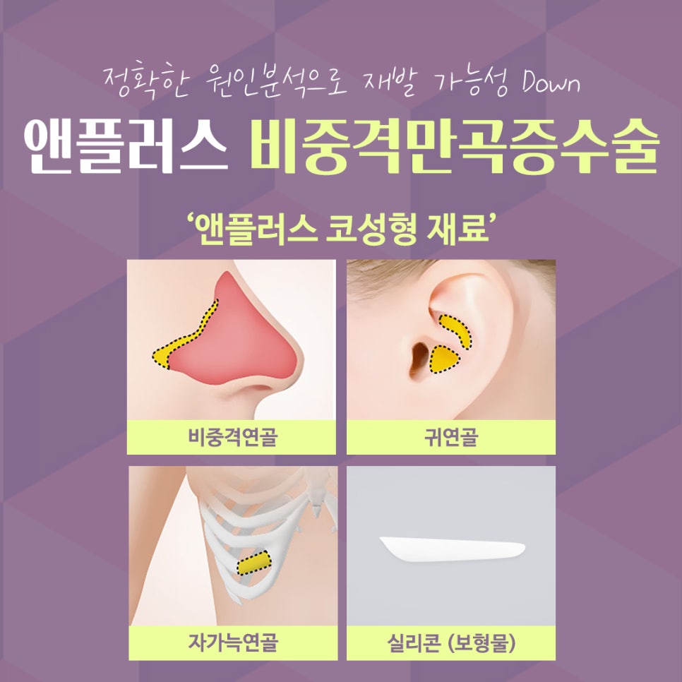 비중격만곡증수술후기 라인까지 고려해서 관련 이미지 12