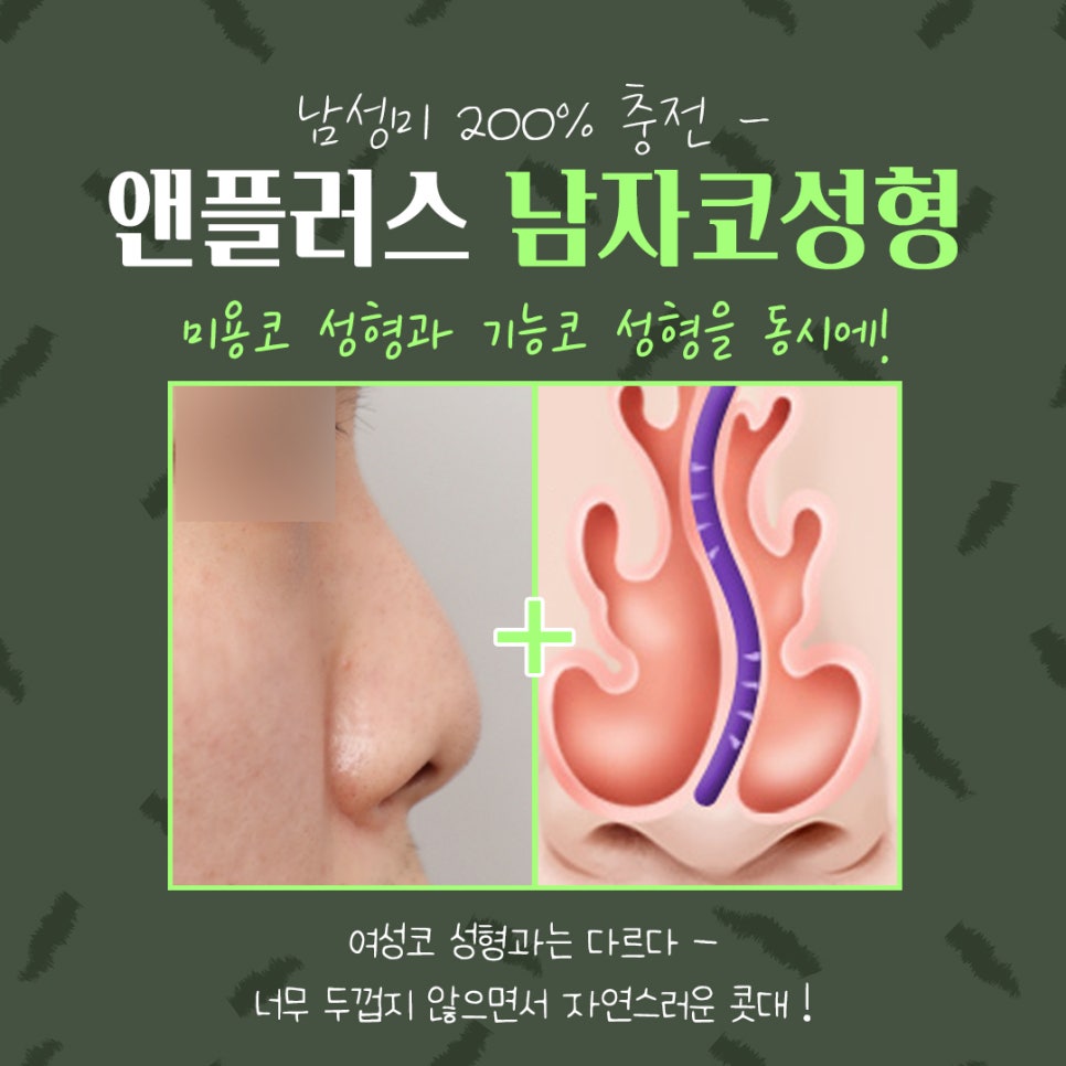 남자코성형 직선코라인으로 기능까지 확인하여 관련 이미지 5