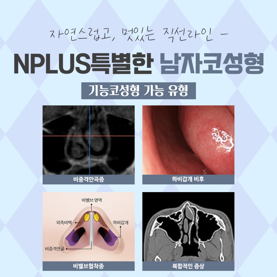 남자코성형전후 강남앤플러스에서 확인 관련 이미지 13