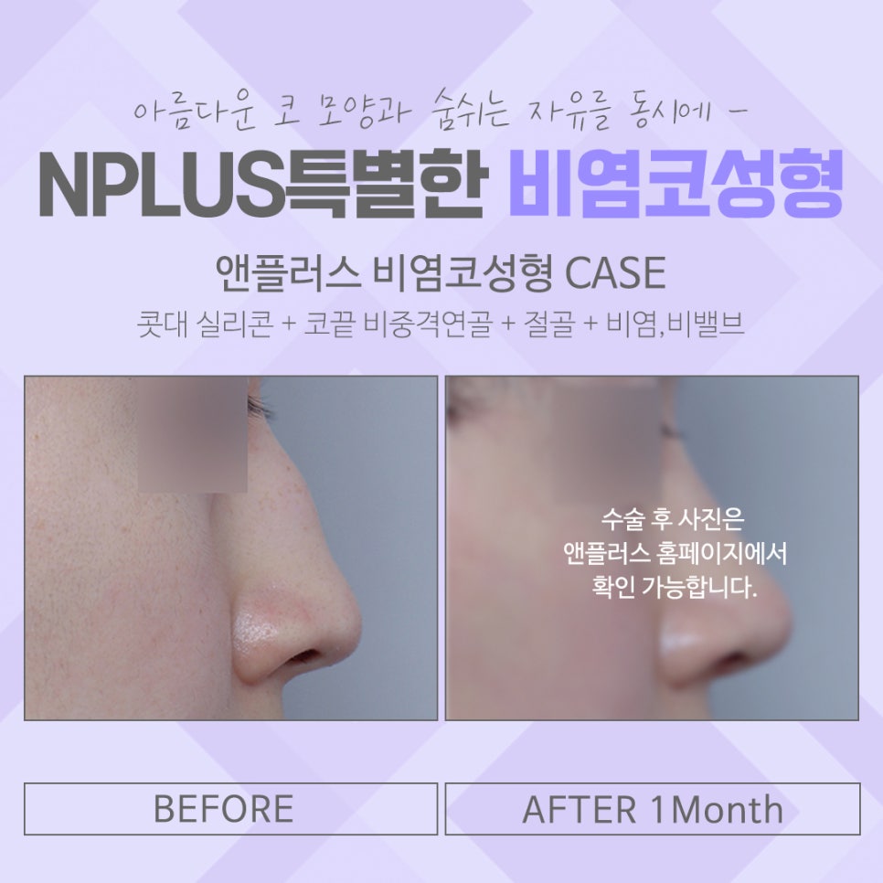 Check Exactly Rhinoplasty and Rhinitis Surgery Reviews image 16