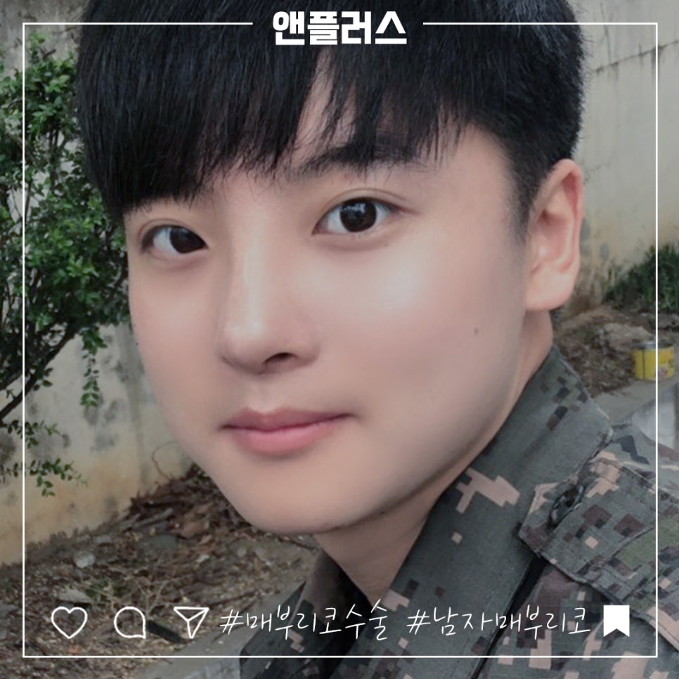 남자매부리코성형 기능까지 고려해서 관련 이미지 1