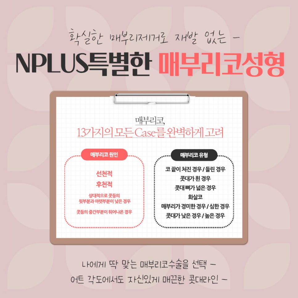 매부리코수술후기 자세하게 알아봐야 관련 이미지 5
