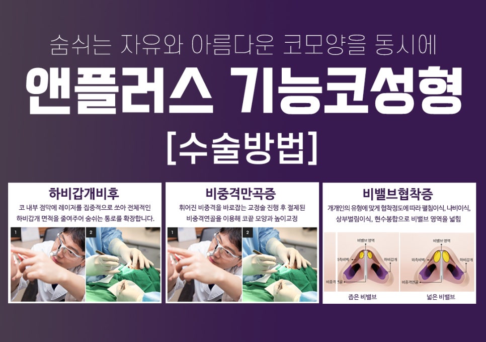 앤플러스에서 알려드리는 성형외과 기능코성형후기 관련 이미지 3