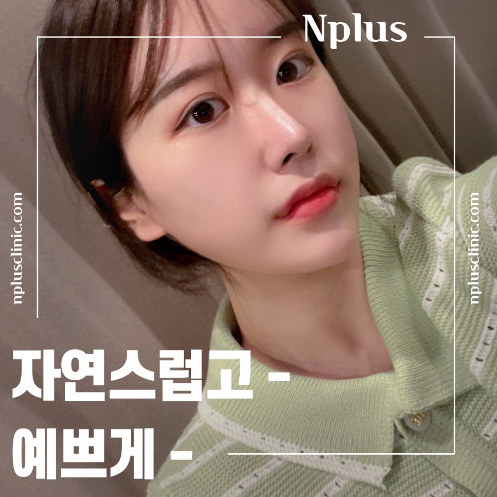 Detailed Hump Nose Surgery Review image 3