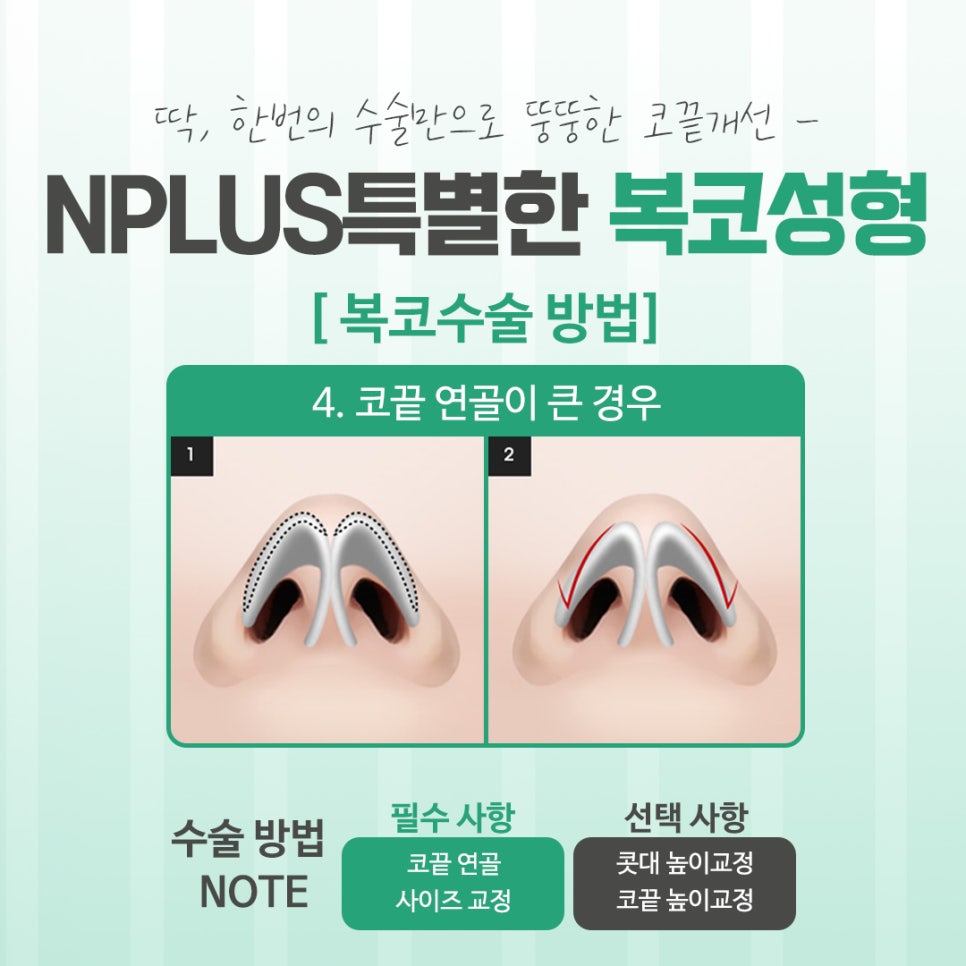 Looking into Various Bulbous Nose Surgery Reviews image 10