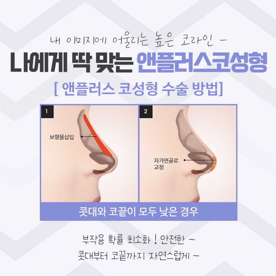 코성형후기 이미지를 예쁘고 자연스럽게 관련 이미지 8