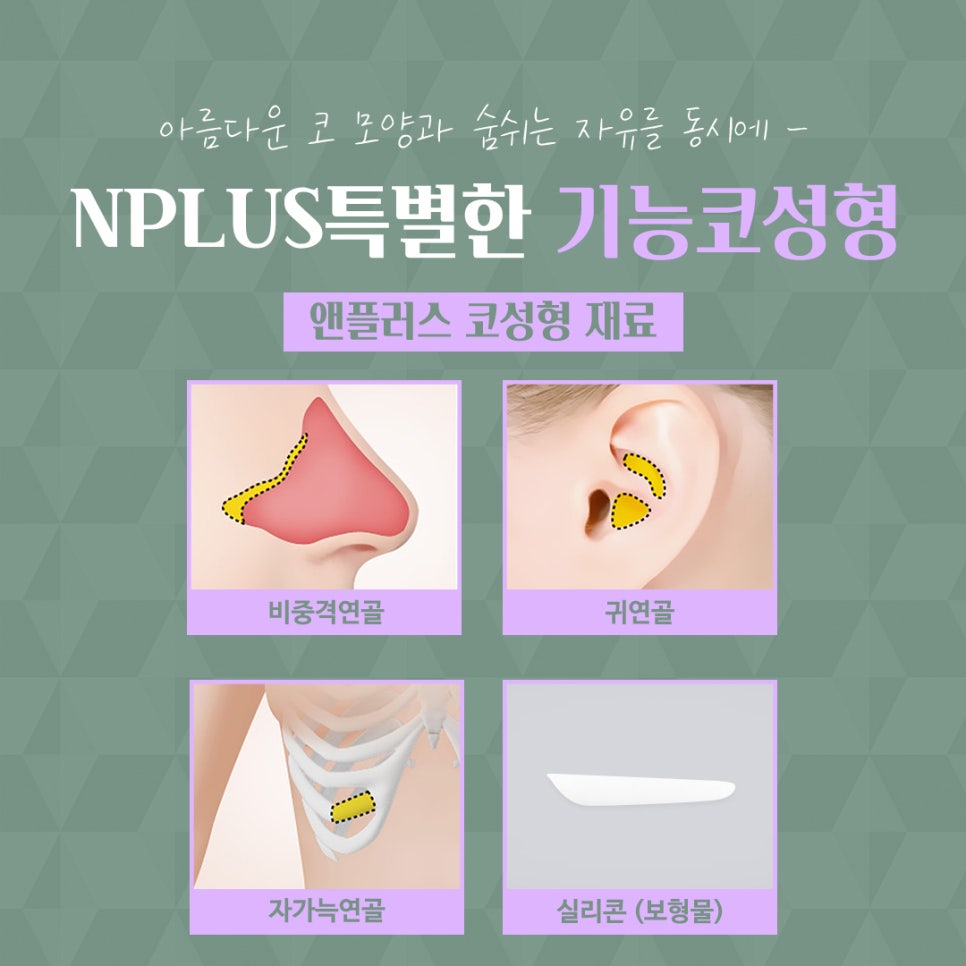 코수술후기 라인까지 고려해서 관련 이미지 10