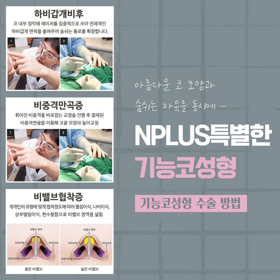코성형후기 자연스럽고 예쁘게 관련 이미지 10