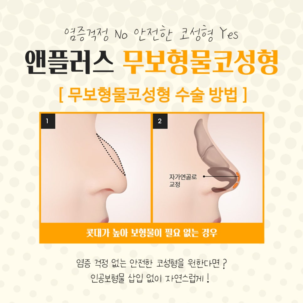 무보형물코수술에 대해 자세하게 알아보고 관련 이미지 7