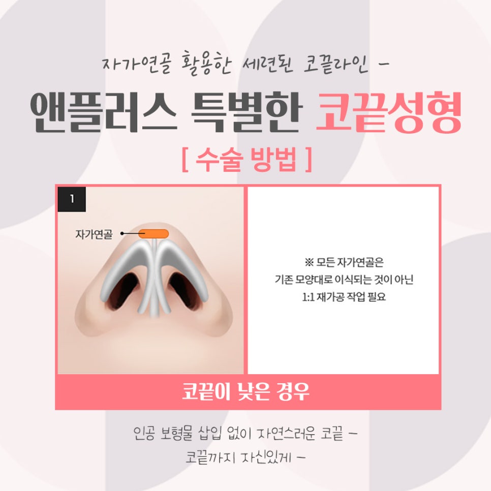 코끝성형후기로 세련된 코 라인 관련 이미지 8